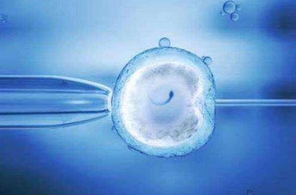 美国加州试管婴儿后遇先兆流产如何去保胎